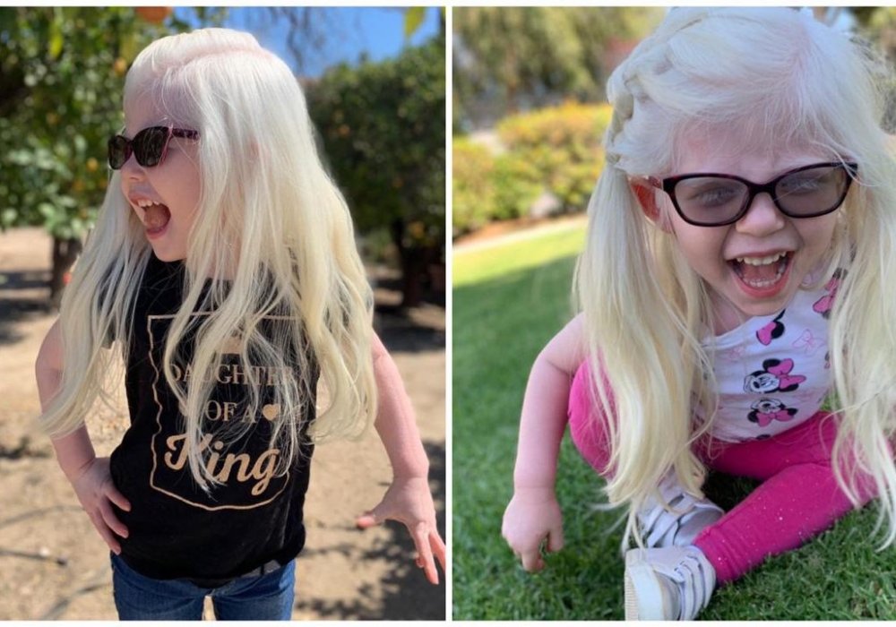 © instagram.com/tatianaprincesswithalbinism